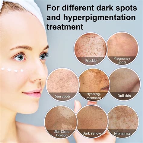 dark spots on skin removal